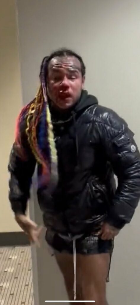 6ix9ine beating aftermath